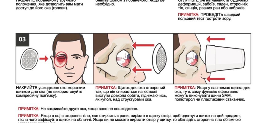 Перша допомога при травмі ока: що робити в екстреній ситуації?