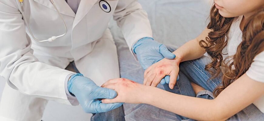 Оптимальний догляд: скільки разів на день обробляти рану зеленкою?