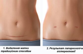 Що можна їсти після видалення матки: корисні поради для здоров’я