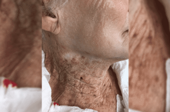 Чому важливо регулярно використовувати СПФ крем для захисту шкіри