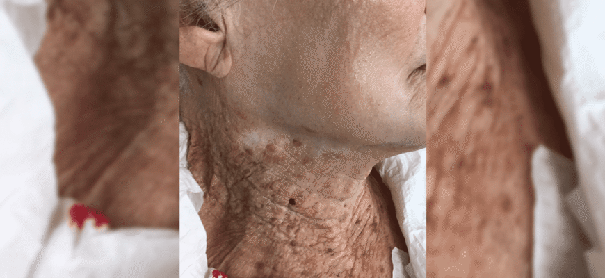 Чому важливо регулярно використовувати СПФ крем для захисту шкіри