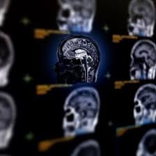 Кіста в голові: визначення, симптоми та методи лікування проблеми Кіста в голові: визначення, симптоми та методи лікування проблеми