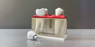 Що таке імплементація: повний огляд поняття та його важливість