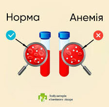Що таке Залізо: ключові властивості, застосування та значення элемента