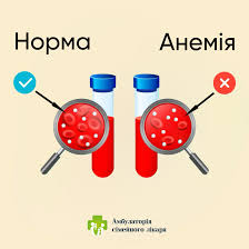 Що таке Залізо: ключові властивості, застосування та значення элемента Що таке Залізо: ключові властивості, застосування та значення элемента