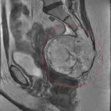 Що таке куприк: визначення, функції та будова крижового відділу