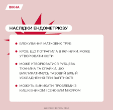 Що таке ендометріоз: симптоми, причини та сучасні методи лікування