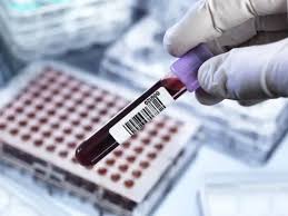 Що таке креатинін в крові: значення, норма та аналіз показників