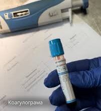 Що таке коагулограма крові: важливість та призначення аналізу