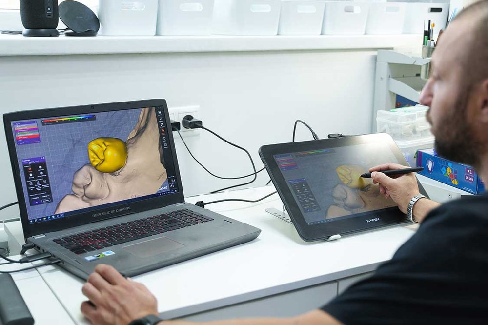 3D-сканування та CAD/CAM у стоматології