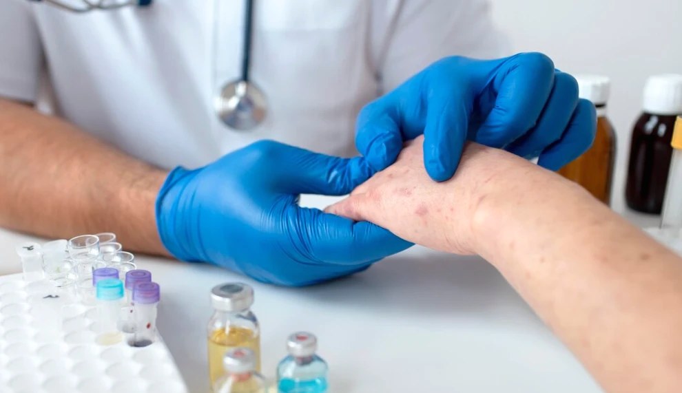 Чи виліковується екзема