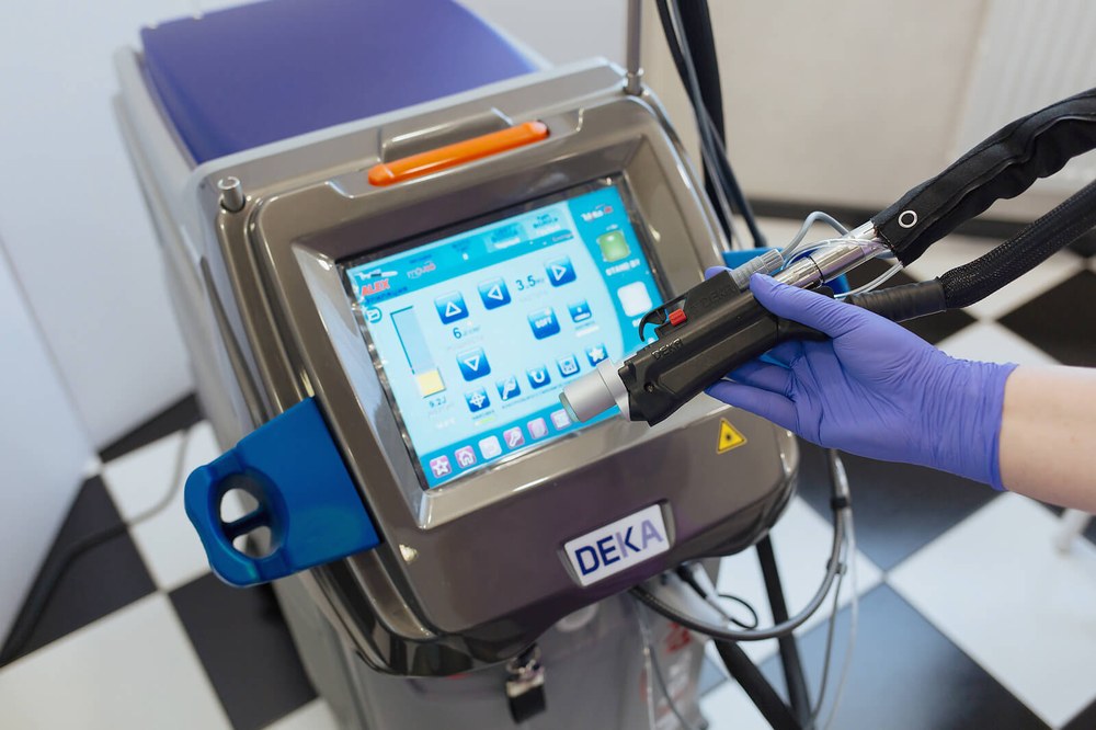 Лазерна епіляція