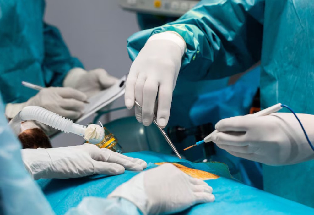 Лапароскопічна процедура