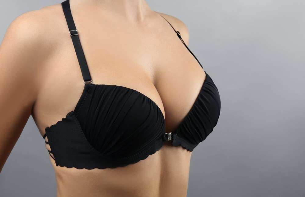 Мамопластика: до та після