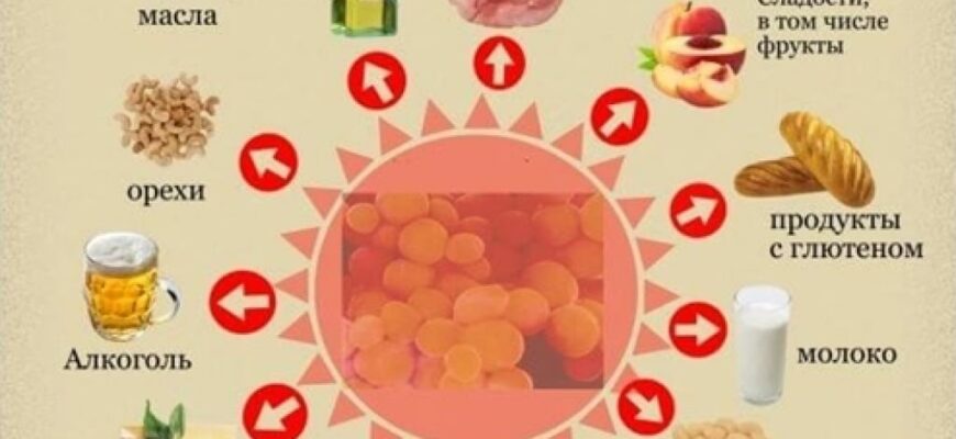 Що не можна їсти при кандидозі кишечника: список заборонених продуктів