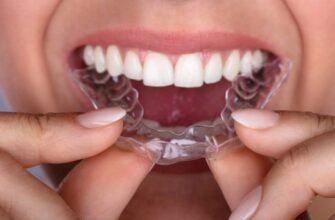 Invisalign капи: оптимальний вибір для ідеального вирівнювання зубів
