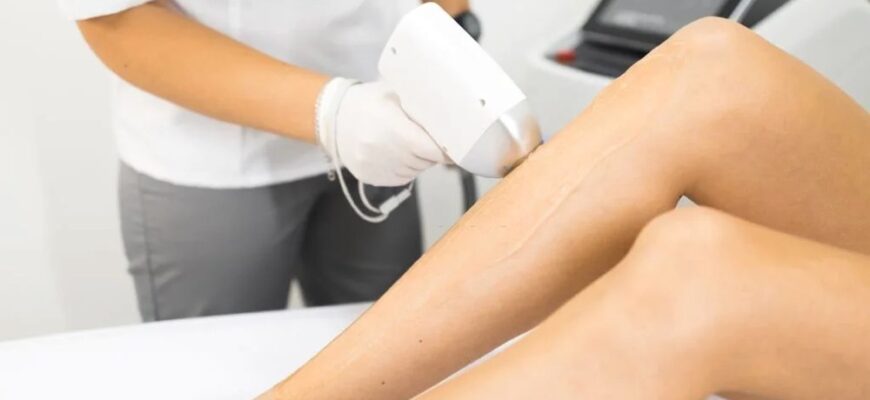 Лазерна епіляція для жінок: найкраще рішення для гладкості шкіри