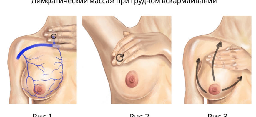 Як безпечно та ефективно усунути застій молока: поради та методи