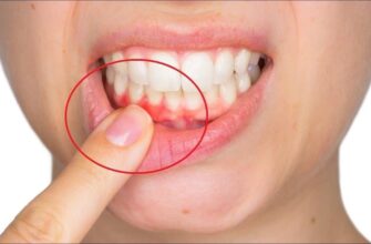 Як ефективно контролювати поширення ясен: ключові методи та засоби