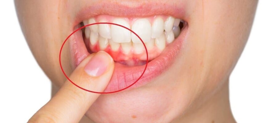 Як ефективно контролювати поширення ясен: ключові методи та засоби