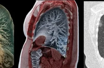 Чи безпечно робити комп’ютерну томографію двічі на місяць?