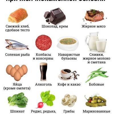 Чи можна їсти мед при жовчнокам’яній хворобі: поради та рекомендації