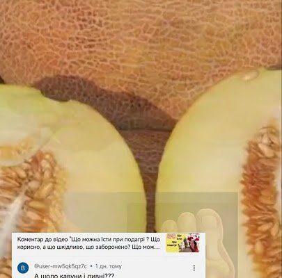 Чи можна їсти кавун при подагрі: поради та рекомендації лікарів