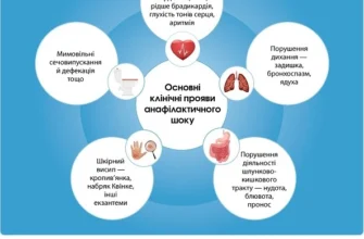 Невідкладна допомога при анафілактичному шоці: покроковий алгоритм дій