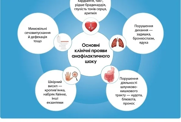 Невідкладна допомога при анафілактичному шоці у дітей: покрокова інструкція