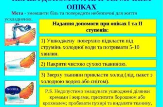 Ефективна перша медична допомога при опіках: поради та рекомендації