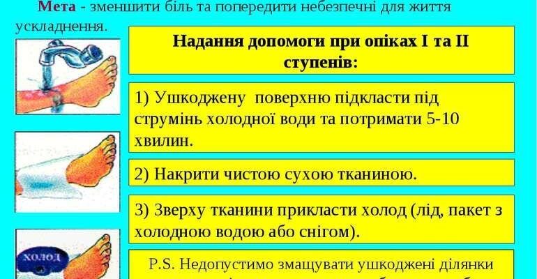 Ефективна перша медична допомога при опіках: поради та рекомендації