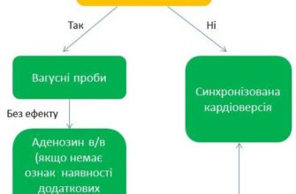 Невідкладна допомога при пароксизмальній тахікардії: що потрібно знати