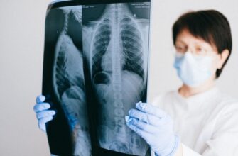 Чи можна їсти перед рентгеном: важливі поради та рекомендації