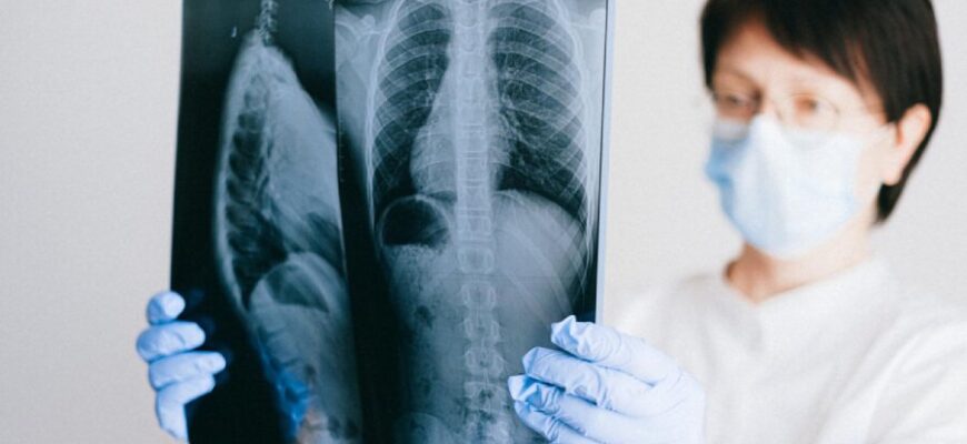 Чи можна їсти перед рентгеном: важливі поради та рекомендації