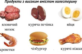 Що можна їсти при високому холестерині: корисні поради та продукти