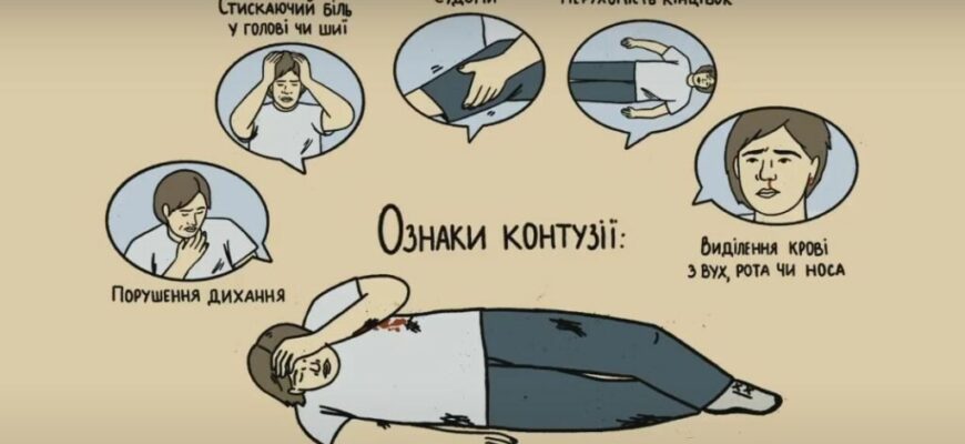 Перша допомога при контузії: основні кроки і рекомендації
