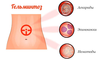 Дієта та харчування при глистах - корисні та небезпечні продукти