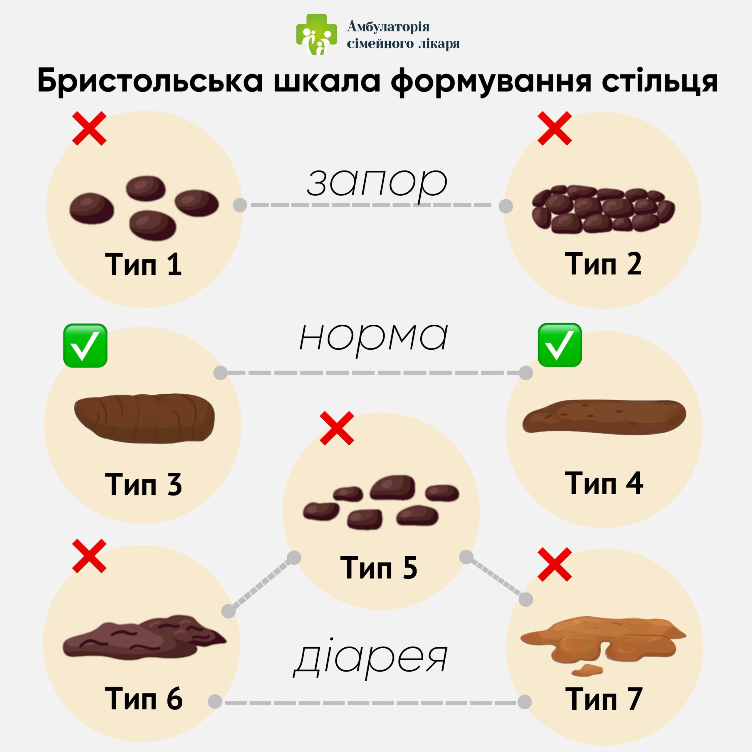 Закреп - симптоми, причини та лікування закрепу