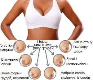 Перші ознаки раку: як розпізнати симптоми на ранніх стадіях Перші ознаки раку: як розпізнати симптоми на ранніх стадіях