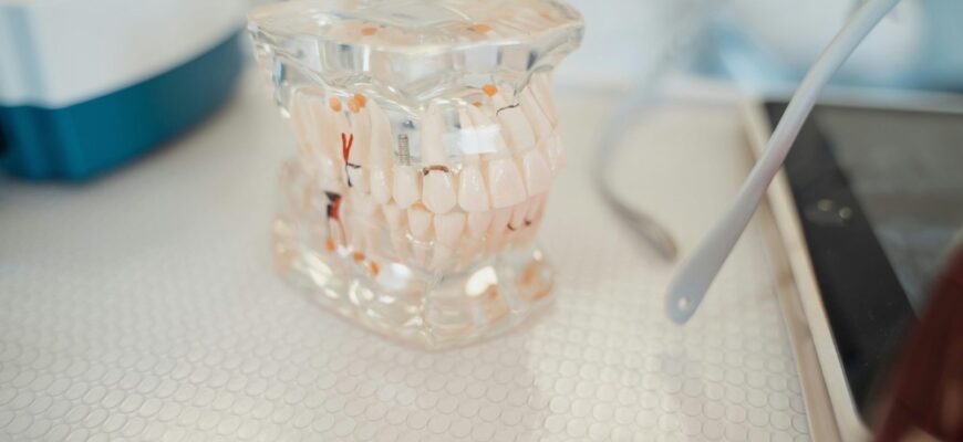 Синус-ліфтинг: інноваційний метод для успішної імплантації зубів