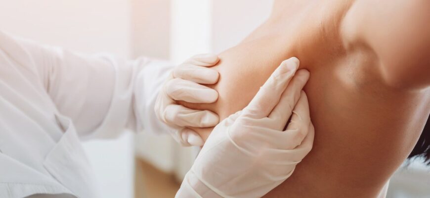 Скільки часу потрібно для загоєння шва після мастектомії: основні фактори Скільки часу потрібно для загоєння шва після мастектомії: основні фактори