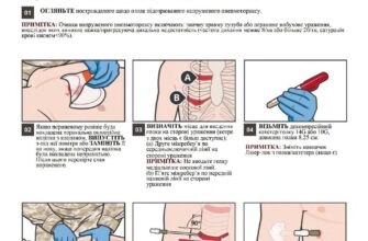 Перша допомога при пневмотораксі: поради для швидкої реакції