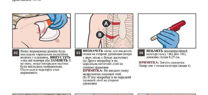 Перша допомога при пневмотораксі: поради для швидкої реакції