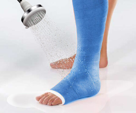 Чим і як ефективно колорувати гіпс: кращі засоби та методи