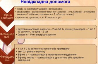 Ефективна невідкладна допомога при нирковій кольці: протокол дій