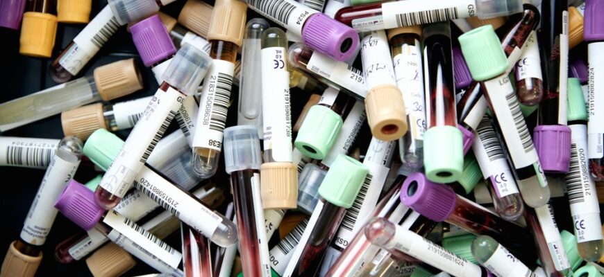 Тести функції печінки (LFT): Повний огляд і пояснення результатів