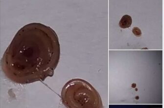 Чи можна їсти рибу з глистами: безпечність та поради фахівців