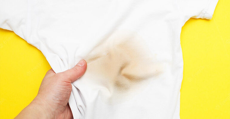 Як ефективно видалити невідому пляму з білих речей: дієві методи