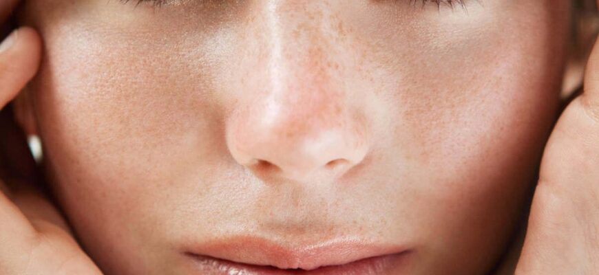 Як ефективно позбутися розширених пор: поради для чистої шкіри
